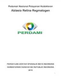 Image of E-book Ablasio Retina Regmatogen
