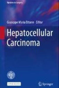 Image of E-book Hepatocellular Carcinoma
